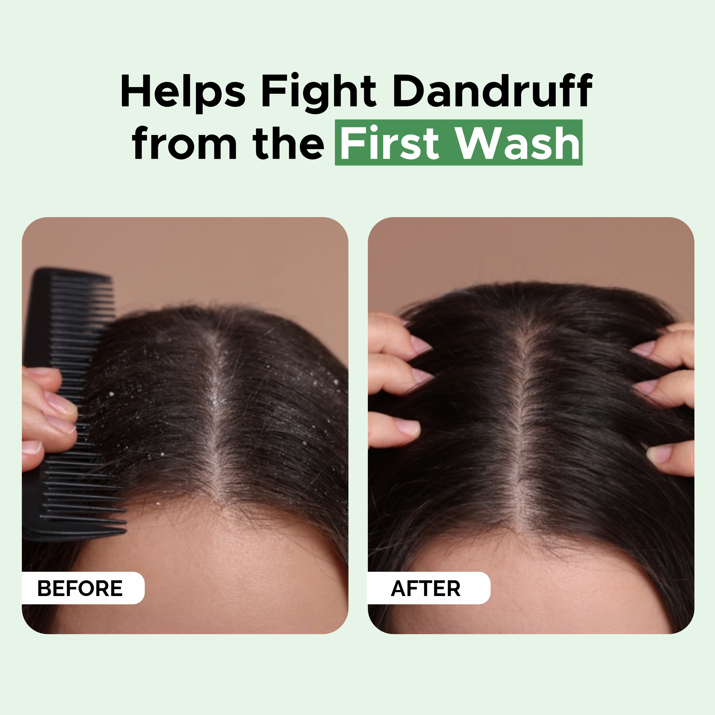 Phillox Anti-Dandruff Shampoo 300ml