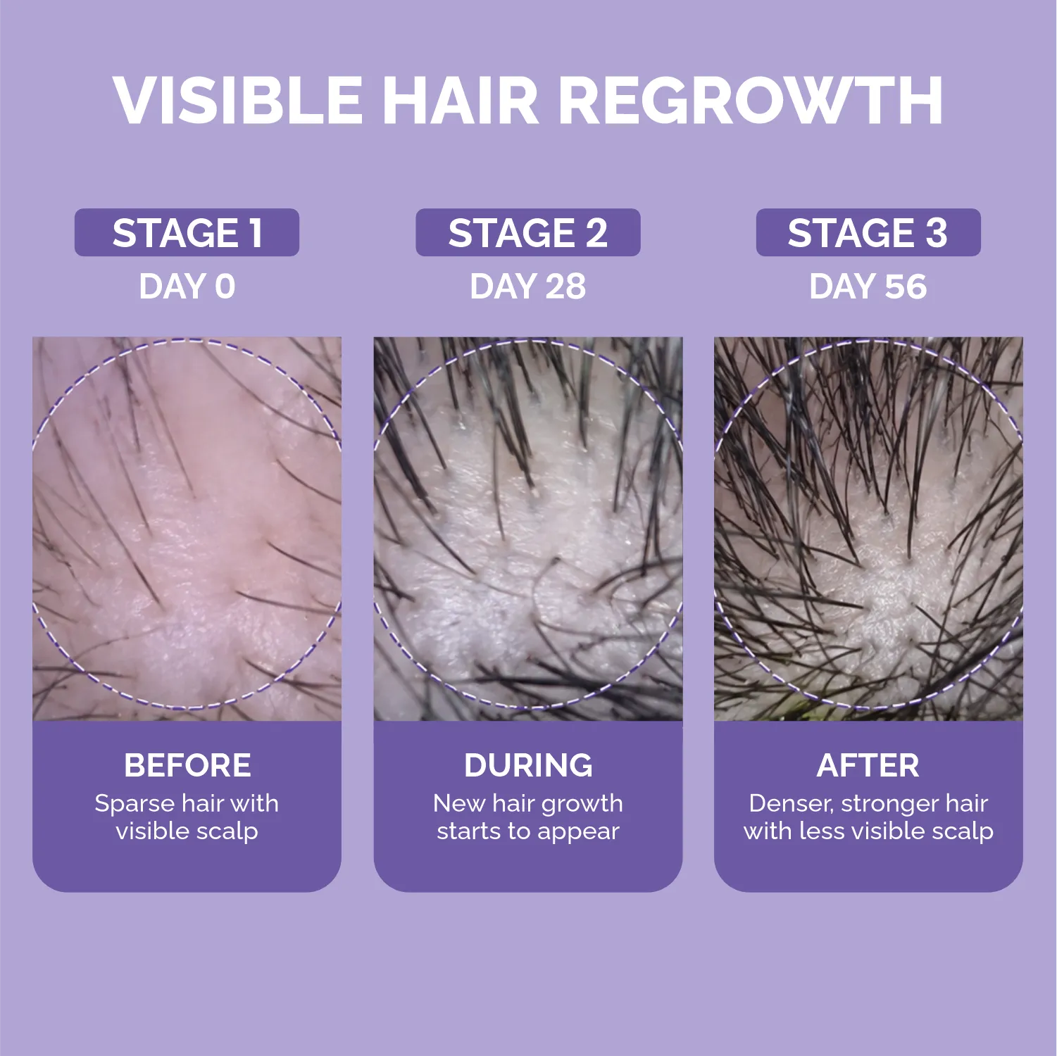 Phillox Hair Growth Serum