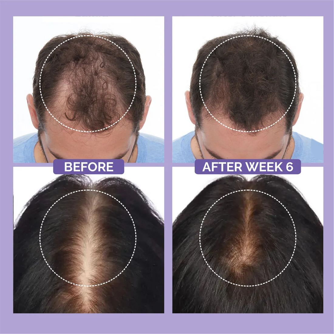Phillox Hair Growth Serum